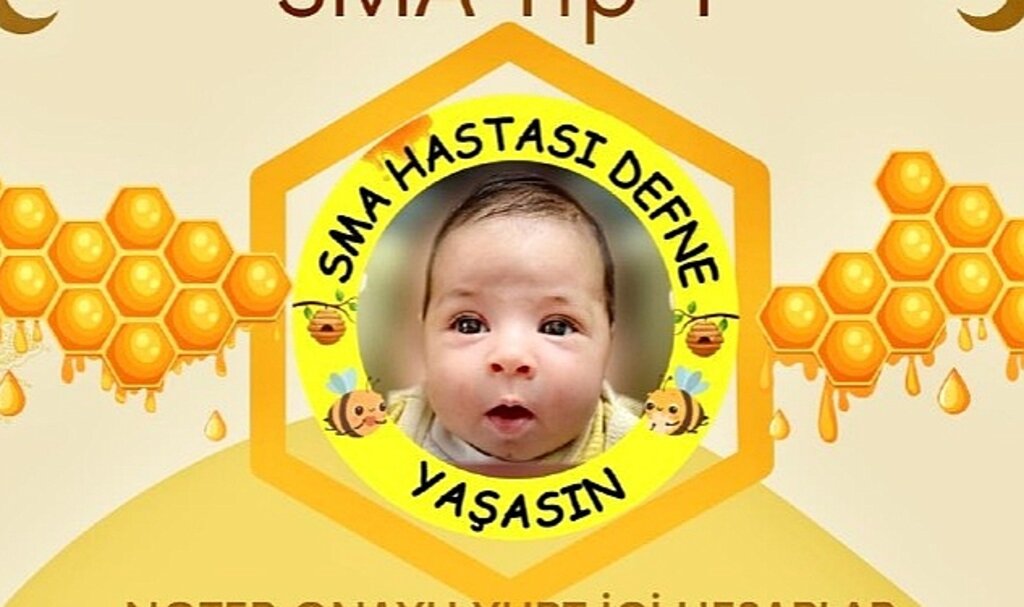 Sma hastası Defne Bebek için Başkan Doğruer'den yardım çağrısı
