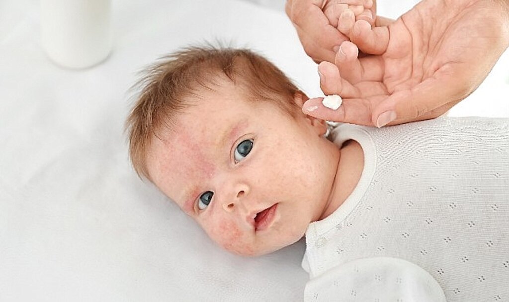 Yenidoğan Dönemindeki İşitme Kaybı Konjenital CMV Enfeksiyonuna İşaret edebilir!